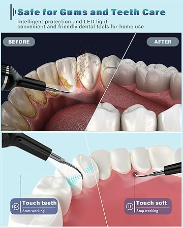 Plaque Remover for Teeth