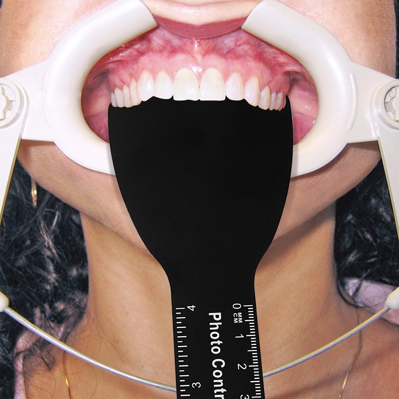 6 Sizes Dental Oral