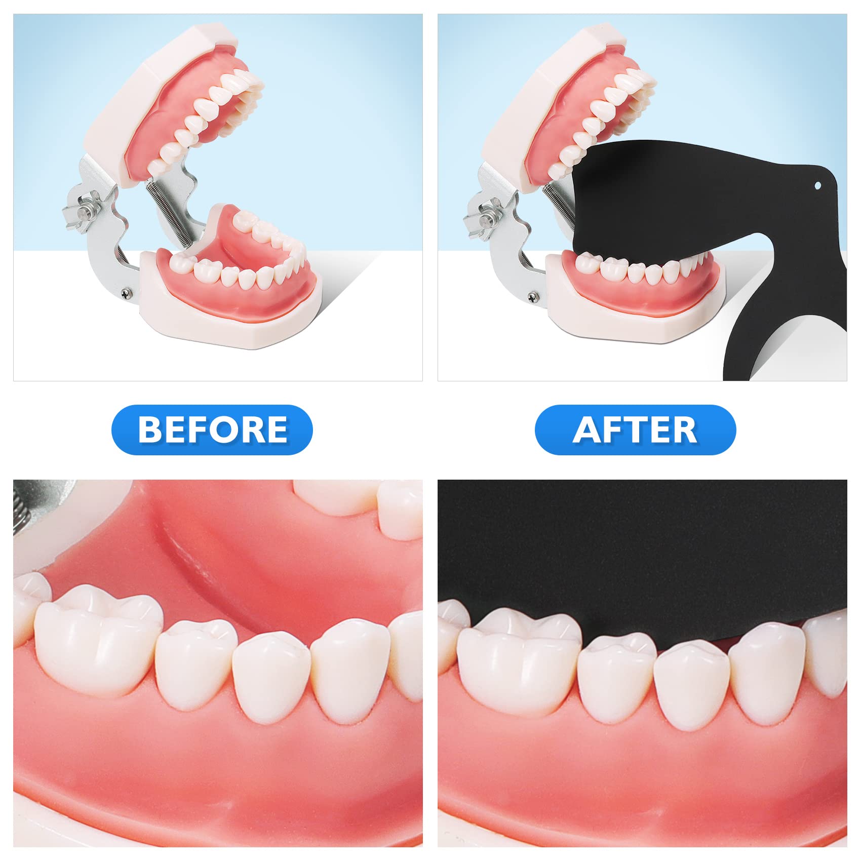 6 Sizes Dental Oral